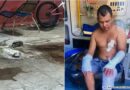 Justiça recebe denúncia contra homem que ateou fogo e matou ex em Teresina