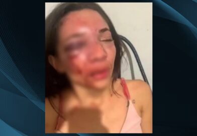 Mulher tem rosto desfigurado após sofrer ataque de namorado em Picos